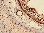 RABGGTA Antibody in Immunohistochemistry (Paraffin) (IHC (P))