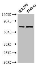 RABGGTA Antibody in Western Blot (WB)