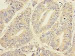 YME1L1 Antibody in Immunohistochemistry (Paraffin) (IHC (P))