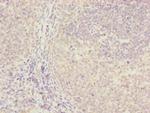 FBXO22 Antibody in Immunohistochemistry (Paraffin) (IHC (P))