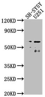 TAIP2 Antibody in Western Blot (WB)