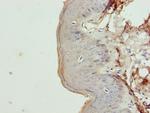 Cytokeratin 35 Antibody in Immunohistochemistry (Paraffin) (IHC (P))