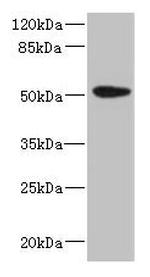 Cytokeratin 35 Antibody in Western Blot (WB)