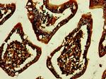 A33 Antibody in Immunohistochemistry (Paraffin) (IHC (P))