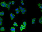 Calponin 2 Antibody in Immunocytochemistry (ICC/IF)