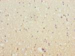 SH3GL2 Antibody in Immunohistochemistry (Paraffin) (IHC (P))