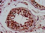 PIN4 Antibody in Immunohistochemistry (Paraffin) (IHC (P))