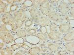 MRPL18 Antibody in Immunohistochemistry (Paraffin) (IHC (P))