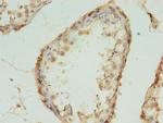 MRPL18 Antibody in Immunohistochemistry (Paraffin) (IHC (P))