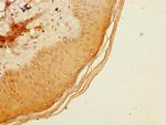 ADAT1 Antibody in Immunohistochemistry (Paraffin) (IHC (P))