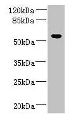 ADAT1 Antibody in Western Blot (WB)