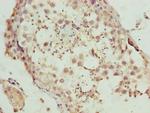 DEFB129 Antibody in Immunohistochemistry (Paraffin) (IHC (P))