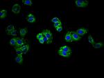 ABCG5 Antibody in Immunocytochemistry (ICC/IF)