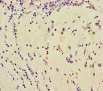 TDRD3 Antibody in Immunohistochemistry (Paraffin) (IHC (P))