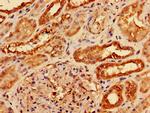 AGPAT3 Antibody in Immunohistochemistry (Paraffin) (IHC (P))