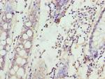 SPTLC3 Antibody in Immunohistochemistry (Paraffin) (IHC (P))