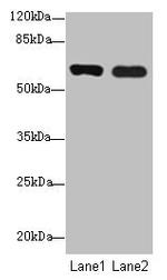 SPTLC3 Antibody in Western Blot (WB)