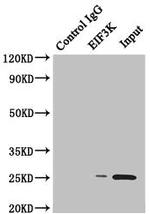 eIF3k Antibody in Western Blot (WB)