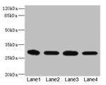 eIF3k Antibody in Western Blot (WB)