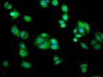 AGXT2 Antibody in Immunocytochemistry (ICC/IF)