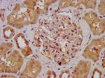 AGXT2 Antibody in Immunohistochemistry (Paraffin) (IHC (P))