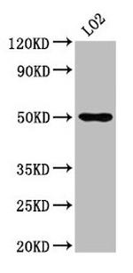 AGXT2 Antibody in Western Blot (WB)