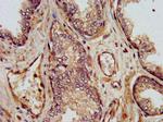 SHARPIN Antibody in Immunohistochemistry (Paraffin) (IHC (P))