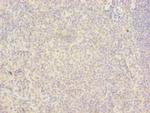 RAB6B Antibody in Immunohistochemistry (Paraffin) (IHC (P))