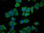 LARS Antibody in Immunocytochemistry (ICC/IF)