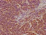 LARS Antibody in Immunohistochemistry (Paraffin) (IHC (P))