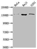 LARS Antibody in Western Blot (WB)