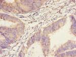 SAV1 Antibody in Immunohistochemistry (Paraffin) (IHC (P))