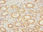 SAV1 Antibody in Immunohistochemistry (Paraffin) (IHC (P))