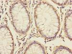 S100A14 Antibody in Immunohistochemistry (Paraffin) (IHC (P))