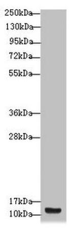 S100A14 Antibody in Western Blot (WB)