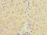 RAB18 Antibody in Immunohistochemistry (Paraffin) (IHC (P))