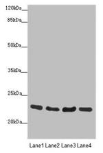 RAB18 Antibody in Western Blot (WB)