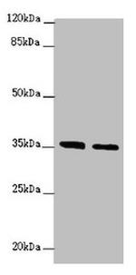 OSGEP Antibody in Western Blot (WB)