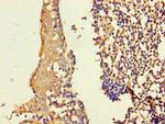 ASF1B Antibody in Immunohistochemistry (Paraffin) (IHC (P))