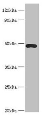 ACTR3B Antibody in Western Blot (WB)