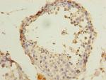 ACTRT3 Antibody in Immunohistochemistry (Paraffin) (IHC (P))