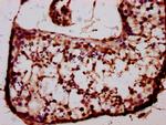 BARHL1 Antibody in Immunohistochemistry (Paraffin) (IHC (P))