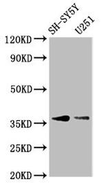 BARHL1 Antibody in Western Blot (WB)