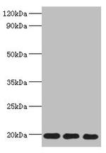 NAT13 Antibody in Western Blot (WB)