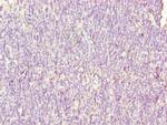 SH3BGRL3 Antibody in Immunohistochemistry (Paraffin) (IHC (P))