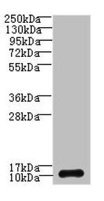 SH3BGRL3 Antibody in Western Blot (WB)