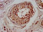 CHMP1A Antibody in Immunohistochemistry (Paraffin) (IHC (P))