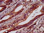 C1GALT1 Antibody in Immunohistochemistry (Paraffin) (IHC (P))