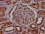 C1GALT1 Antibody in Immunohistochemistry (Paraffin) (IHC (P))