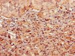 RMND1 Antibody in Immunohistochemistry (Paraffin) (IHC (P))